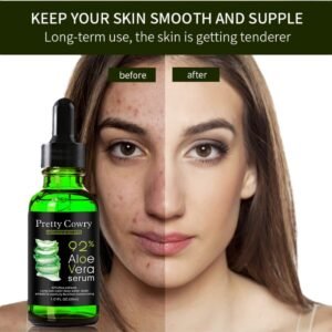 سيروم الالوفيرا - COMFOR BEAUTY